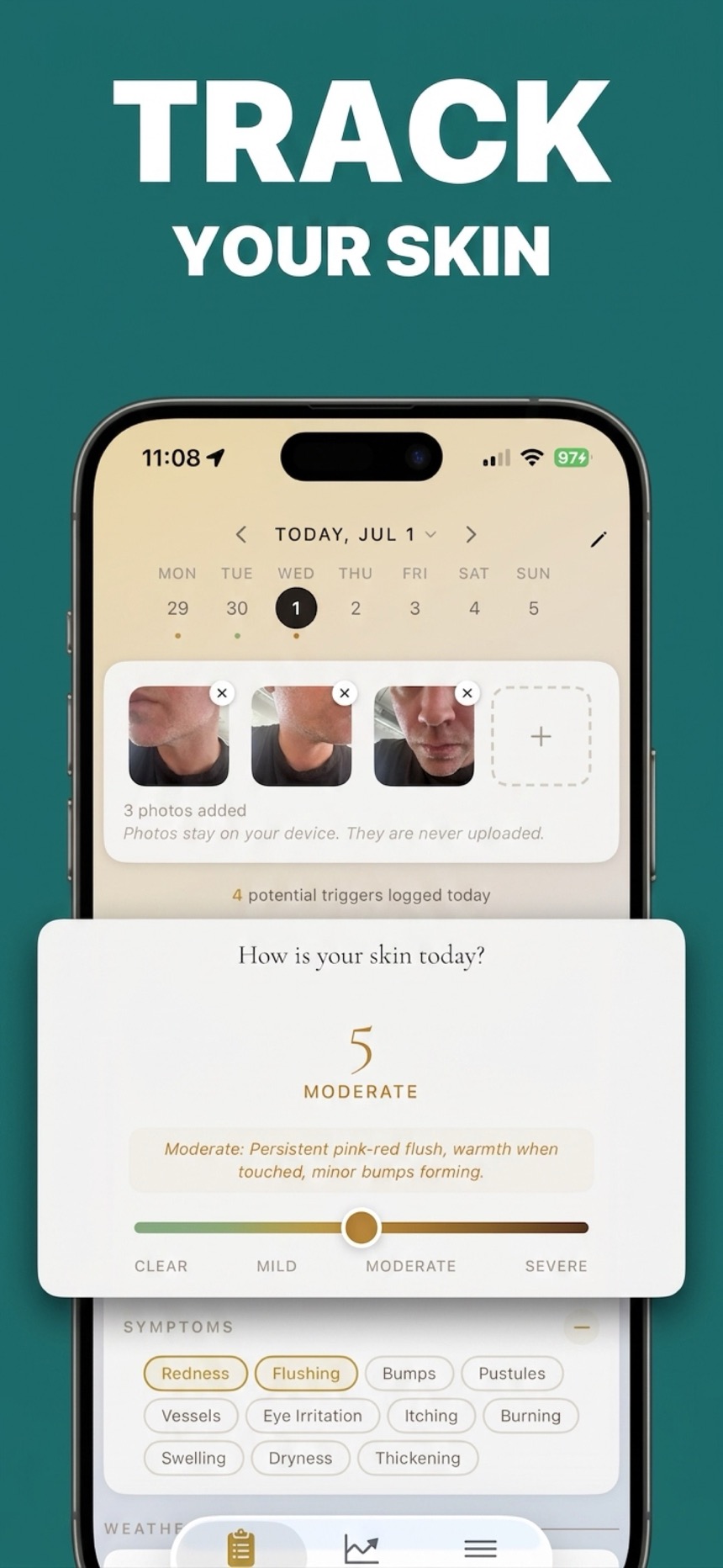 Track your skin — Daily check-in with photos, severity slider, and symptoms